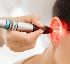 auriculothérapie au laser