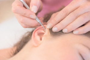 Accompagnement en Réflexologie Auriculaire & Faciale au Laser Tabac • Alimentation • Stress • Sommeil
